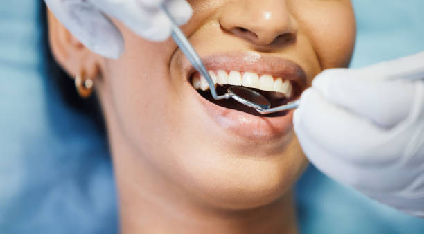 Best Emergency Dental Care for Sports Injuries in Pocono Springs, PA